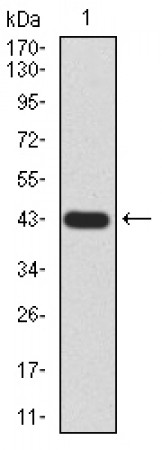 GLI1 Primary Antibody MP30831 [M1B9F8]