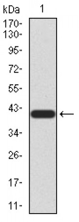NTRK2 Primary Antibody MP30882 [M8D2E8]