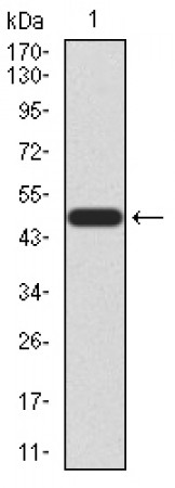 KLF6 Primary Antibody MP30884 [M4C7D6]