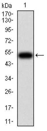 CFHR5 Primary Antibody MP30966 [M3E1E10]