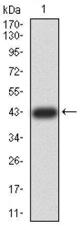 ZFP91 Primary Antibody MP31085 [M8C3D5]