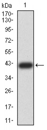 BUB1 Primary Antibody MP31087 [M1A11C7]