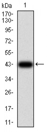 TCF4 Primary Antibody MP31149 [M7B1B3]