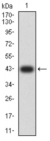 ATP2A1 Primary Antibody MP31210 [M4F11F6]