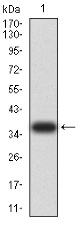 HAVCR1 Primary Antibody MP31247 [M3A12E10]