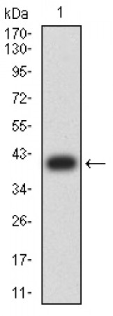 BCL6 Primary Antibody MP31319 [M1H8D10]