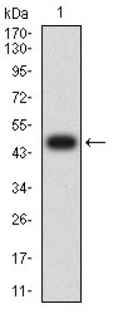 FOLR1 Primary Antibody MP31396 [M3G12B7]