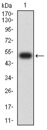 CHRNE Primary Antibody MP31461 [M5F11G8]
