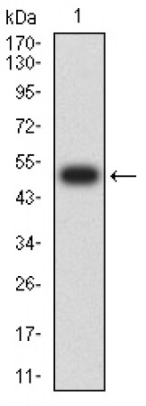 CD120B Primary Antibody MP31555 [M7G8B6]