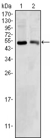 BDH1 Primary Antibody MP30003 [M1A5]