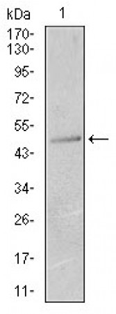 KRT13 Primary Antibody MP30391 [M3G4]