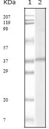 KSHV ORF62 Primary Antibody MP20017 [M5B7B6]