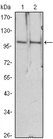 HDAC4 Primary Antibody MP20423 [M7B2]