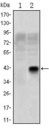 OLIG2 Primary Antibody MP30167 [M1G11]