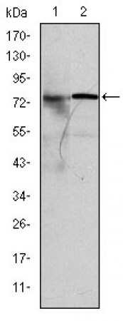 KID Primary Antibody MP30275 [M5F3]
