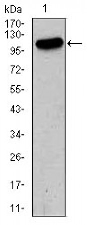 GRIA2 Primary Antibody MP30382 [M7G6]