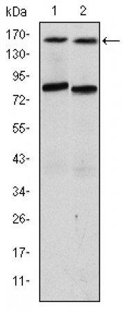 AIB1 Primary Antibody MP30263 [M5H3]
