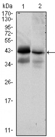 EPCAM Primary Antibody MP30049 [M7E11]