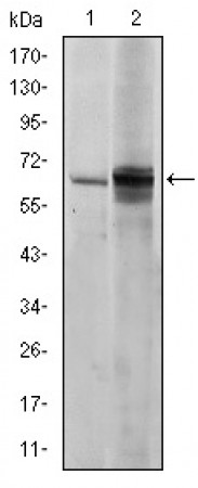 FYN Primary Antibody MP30230 [M2H8]