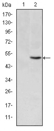 MTHFR Primary Antibody MP30204 [M5D3]