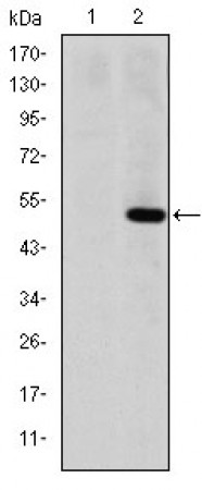 MMP1 Primary Antibody MP30236 [M6A5]