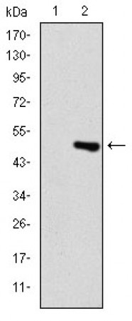 TNNI2 Primary Antibody MP30278 [M2F12A8]