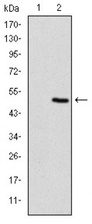 MAP2K5 Primary Antibody  MP30650T [M5H11B10]