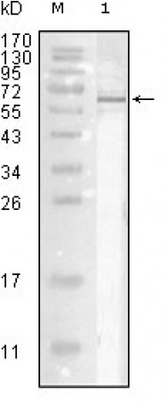 Influenza A virus Nucleoprotein Primary Antibody MP20170 [M9C11]