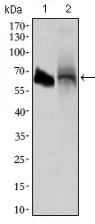 ALPI Primary Antibody  MP30481P[M3B10E7]