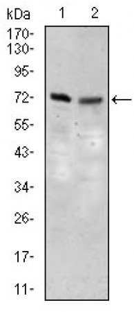 SLC27A5 Primary Antibody MP30454P  [M4B11C10]