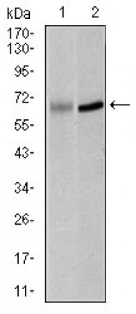PLK1 Primary Antibody MP30396 [M3C11]