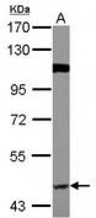 Anti-BACE1 / BACE Antibody MX-C155223