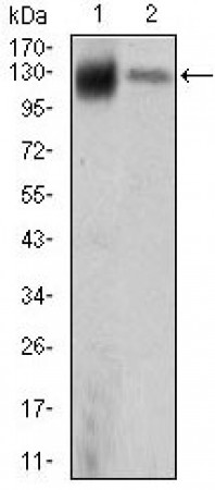 KIF11 Primary Antibody MP20442 [M3B7B2]