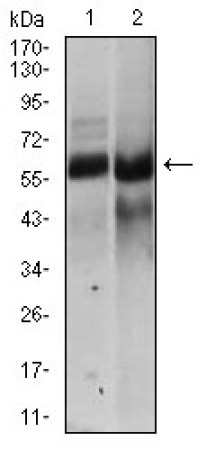 HAS2 Primary Antibody MP30417 [M4E7]