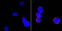 CD18 Primary Antibody MP20346 [M10E12]