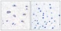 Anti-BACE1 / BACE Antibody (aa452-501) MX-C198667