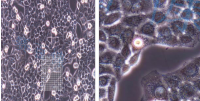 MCF0082  人肺腺癌细胞；SPC-A-1