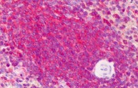 Anti-BACE1 / BACE Antibody (phospho-Ser498) IHC-plus™ MX-B5025