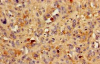 Anti-BACE1 / BACE Antibody MX-C498437