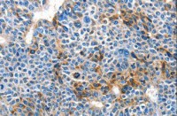Anti-BACE1 / BACE Antibody MX-C400595