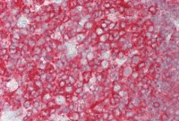Anti-BCHE / Cholinesterase Antibody (aa29-150, Biotin) MX-C298392