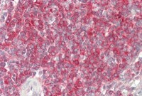 Anti-BTK Antibody IHC-plus™ MX-B14229