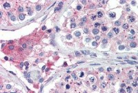 Anti-BACE2 Antibody (aa44-59) IHC-plus™ MX-B3747
