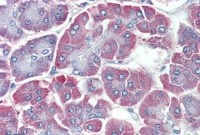 Anti-BACE2 Antibody (C-Terminus) IHC-plus™ MX-B3764