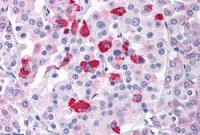 Anti-BACE1 / BACE Antibody (Internal) IHC-plus™ MX-A8893