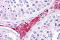 Anti-BACE1 / BACE Antibody (aa72-121) IHC-plus™ MX-B4664