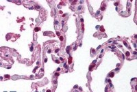 Anti-BACE2 Antibody (aa44-59) IHC-plus™ MX-B744