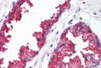 Anti-BACE1 / BACE Antibody (C-Terminus) IHC-plus™ MX-A8549