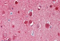 Anti-BCHE / Cholinesterase Antibody IHC-plus™ MX-B7912