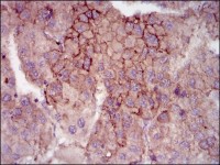 MELK Primary Antibody MP30374 [M2G2]